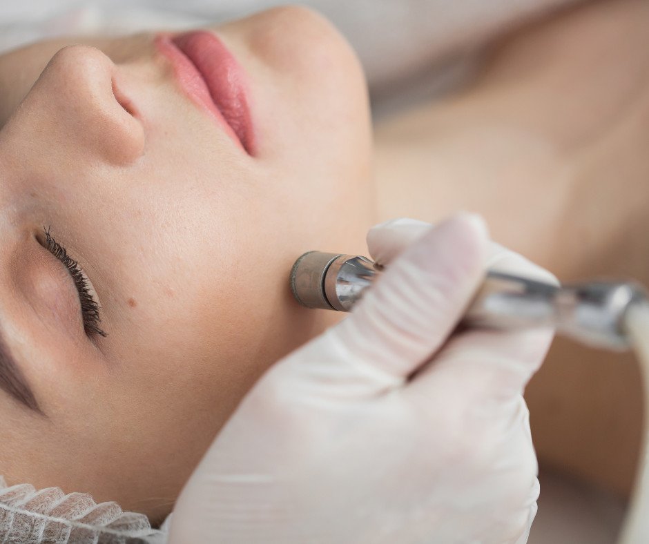 Microdermabrasion